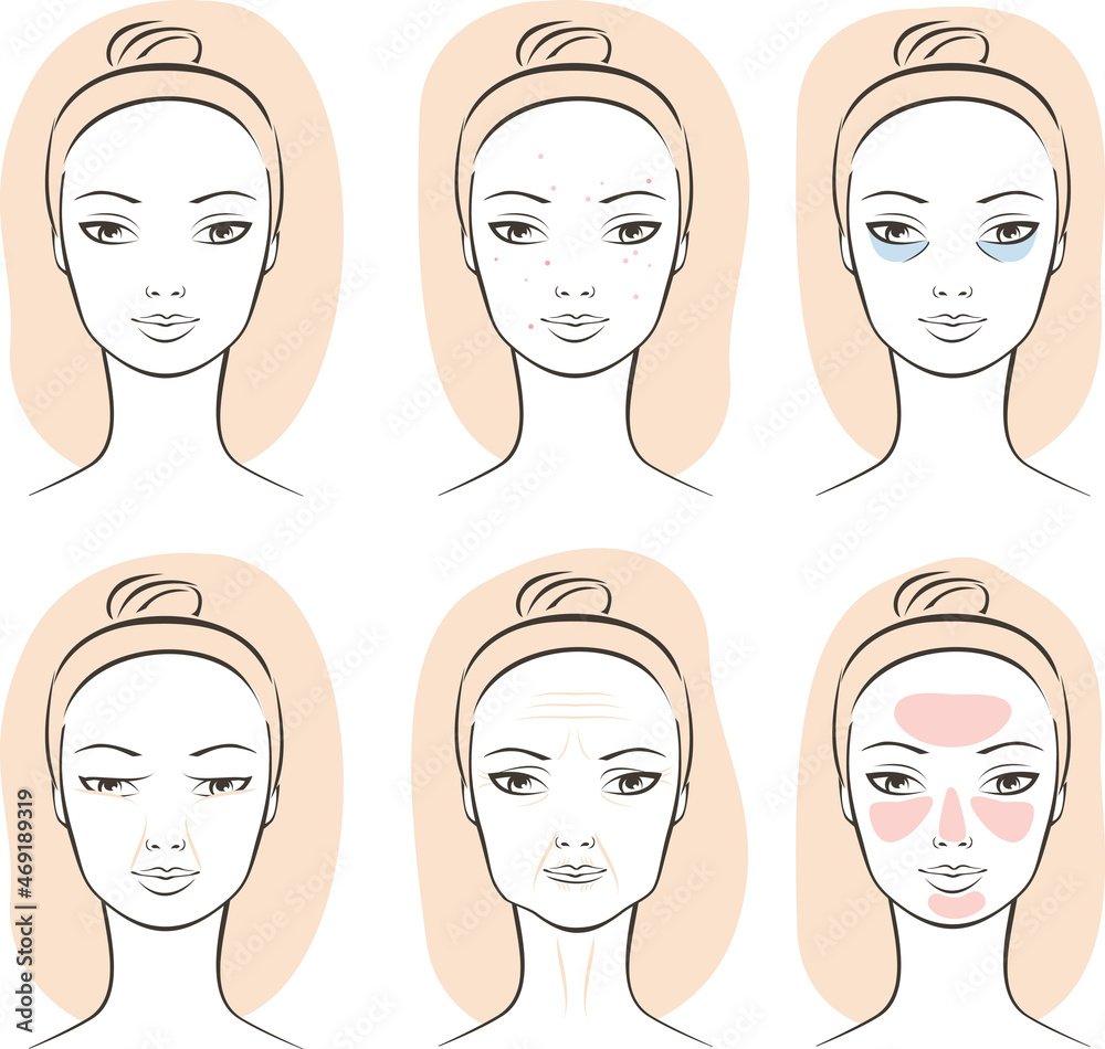 Facial skin problems: acne, blackheads, pimples, dark circles, ptosis, wrinkles, rosacea, face swelling. Skincare set. Facial skin problems: acne, blackheads, pimples, dark circles, ptosis, wrinkles, rosacea, face swelling. Skincare set.