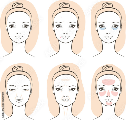  Facial skin problems: acne, blackheads, pimples, dark circles, ptosis, wrinkles, rosacea, face swelling. Skincare set.