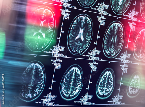 Human brain scan in neurology clinic
