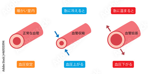 ヒートショック　血管収縮　血管拡張 photo