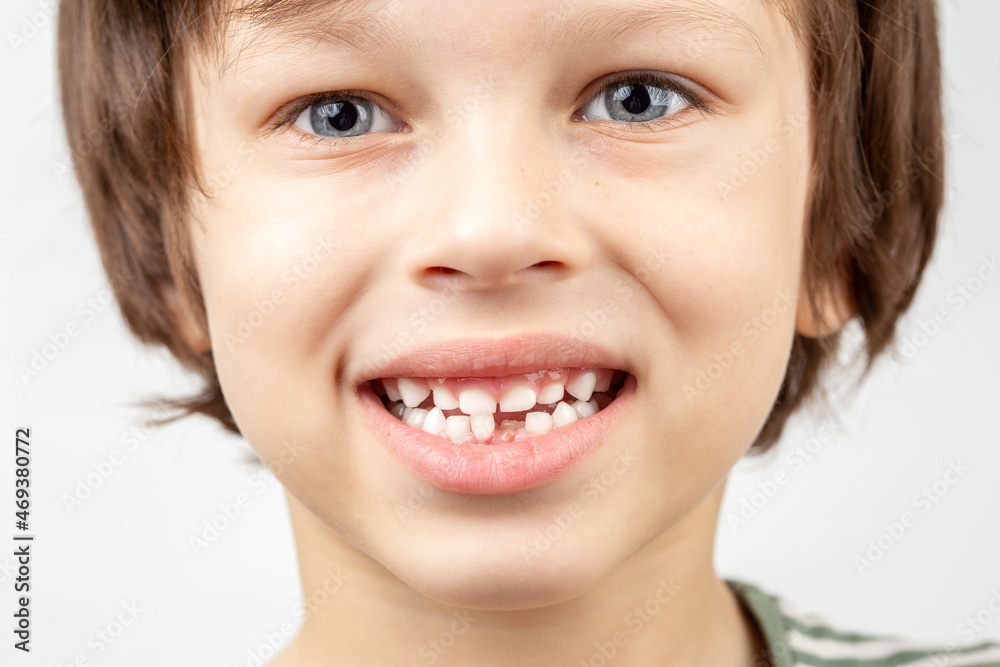 Male child without one bottom front tooth Male child without one bottom front tooth