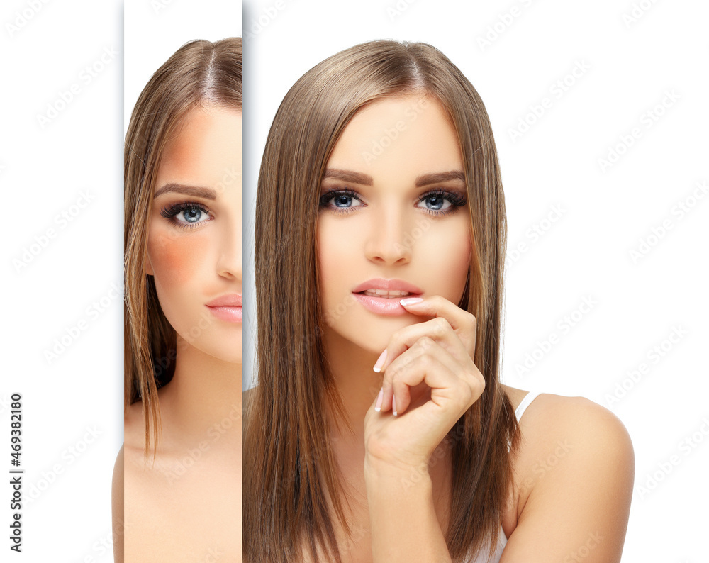 Dark spots, freckles,hyperpigmentation(melasma or chloasma),concept - skin lightening, skin whitening, fruit acids,AHA, Skin Brightening. Dark spots, freckles,hyperpigmentation(melasma or chloasma),concept - skin lightening, skin whitening, fruit acids,AHA, Skin Brightening.