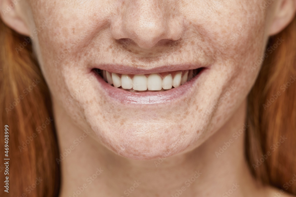 Close up shot of red haired woman with freckles smiling at camera, focus on white teeth, copy space