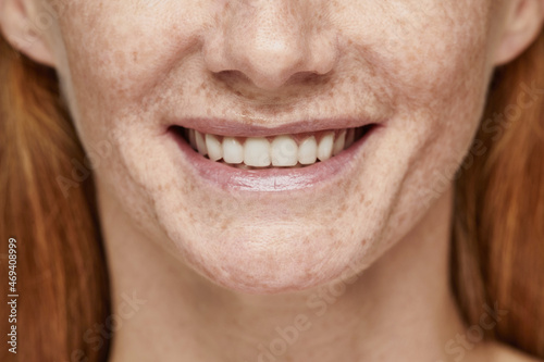 Close up shot of red haired woman with freckles smiling at camera, focus on white teeth, copy space