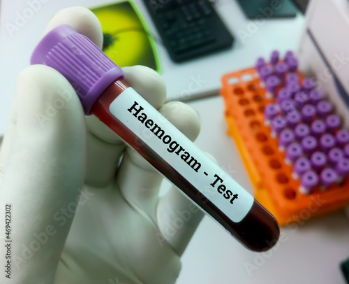 Technician hold blood sample for Haemogram or CBC with lab background. complete Blood Count (CBC)