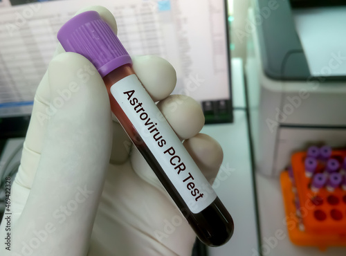 Laboratory scientist hold blood sample with blur background for Astrovirus PCR test, health and medical concept photo