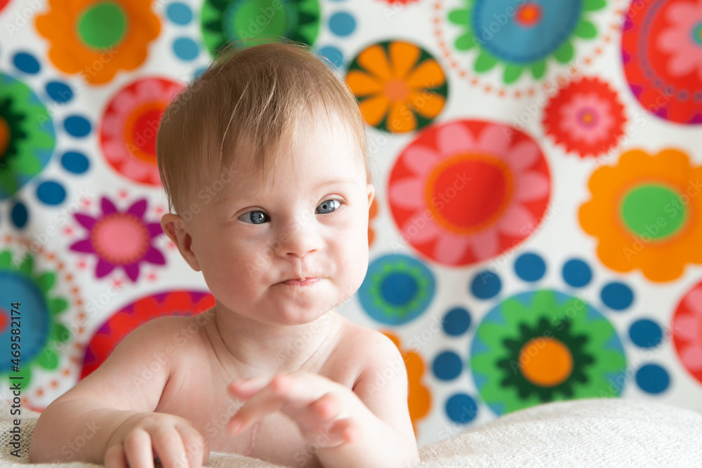 Portrait of a positive girl with Down syndrome. Portrait of a positive girl with Down syndrome.