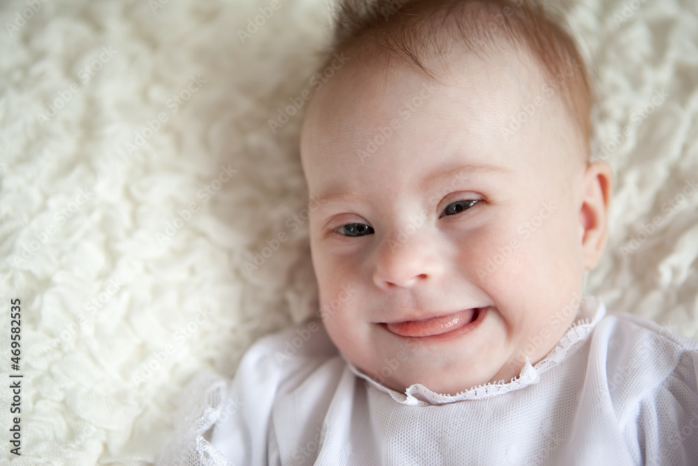 Portrait of a positive girl with Down syndrome. Portrait of a positive girl with Down syndrome.