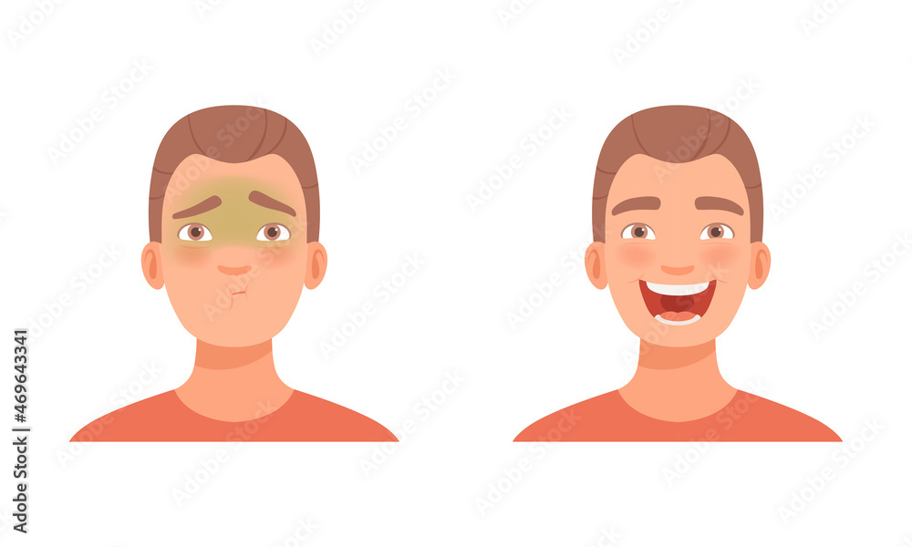 Man Head with Sickness and Laugh as Facial Expression Vector Set Man Head with Sickness and Laugh as Facial Expression Vector Set