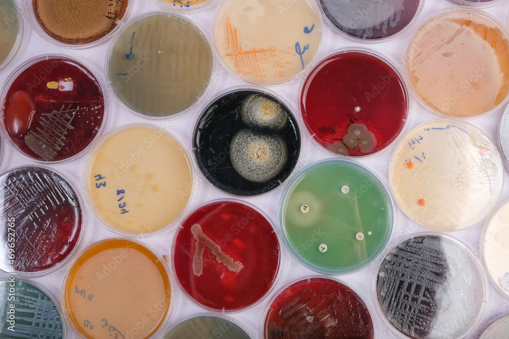 Collection Of Culture Plates Contain Growth Of Microorganisms On 