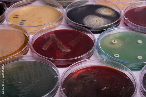 Canvas Print collection of culture plates contain growth of microorganisms on different agar