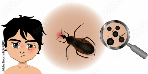 Аmerican triatom bug on white background. Vector illustration