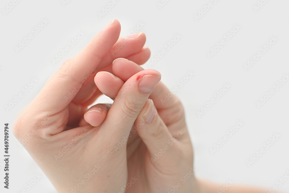 Woman treats the wound on the finger. Urgent help with wounds and bleeding. Wound with blood and leather on the the finger. Medical processing and treatment of bloody cracks drugs. Woman treats the wound on the finger. Urgent help with wounds and bleeding. Wound with blood and leather on the the finger. Medical processing and treatment of bloody cracks drugs.