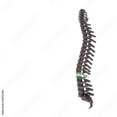 black spine with glass vertebrae.