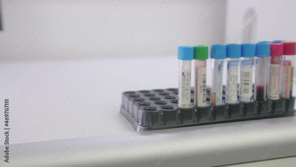Close-up of the Hand in Glove Taking Test Tubes With Material for Laboratory Testing or Experiments. Medical Equipment for Research. Pharmaceutical Laboratory.