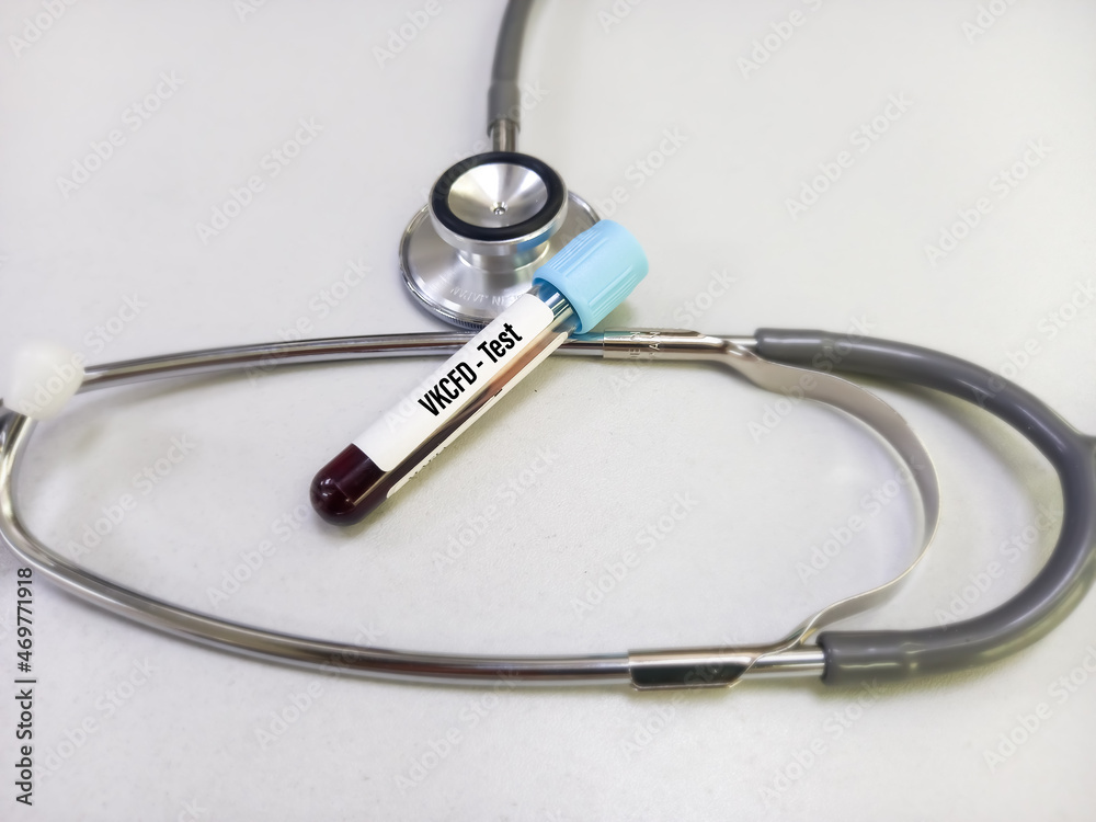 Blood sample for VKCFD(vitamin Kdependent clotting factors deficiency