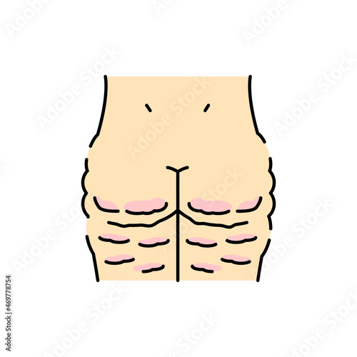Cellulite color line icon. Human diseases.