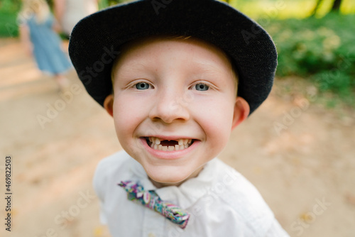 Closeup portrait of a young boy smiling with two missing front teeth photo