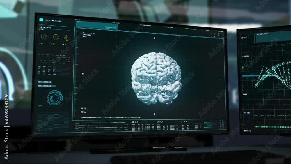 3d Visualization Of Brain In Modern Medical Software To Detect Oncology ...