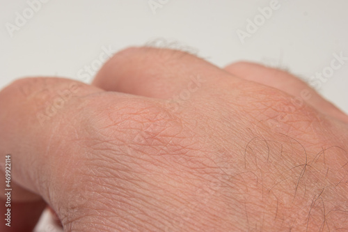 Caucasian male hand with black hair follicles macro close up shot