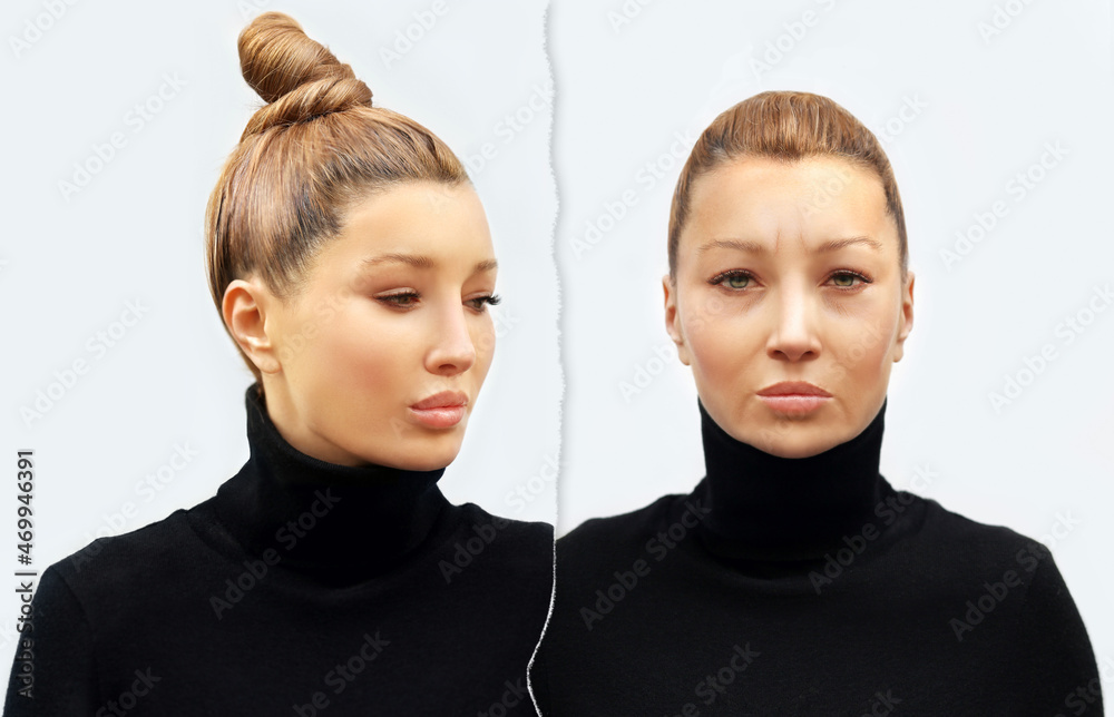 Effects of ageing,Frown/scowl lines ,Nasolabial folds,Neck ,Under eye circles,neck lines