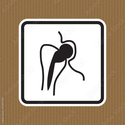No Access For People With Metallic Implants