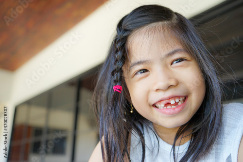 Asian little cute girl lost her central incisor tooth. Loss of milk tooth. Children's dentistry. Beautiful smile.