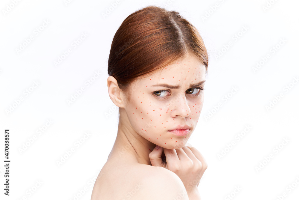sad woman with bare shoulders red dots on her face