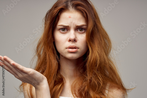 beautiful woman in a white t-shirt pimples on the face close-up