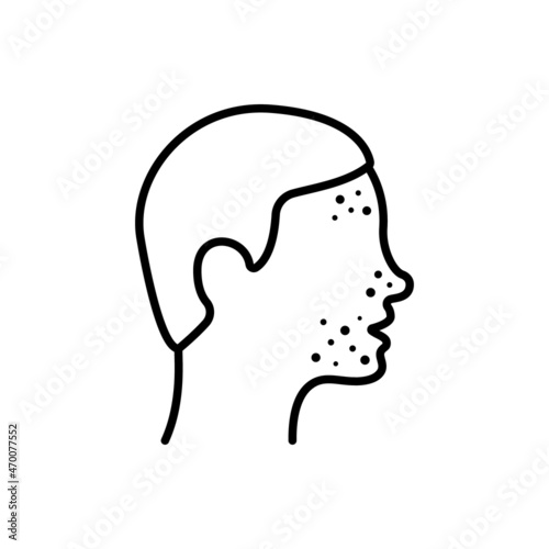 Boy with Pimples on Face Line Icon. Man with Blackhead, Acne, Rash Linear Pictogram. Dermatologic Problem, Allergy, Inflammation Skin Outline Icon. Editable Stroke. Isolated Vector Illustration