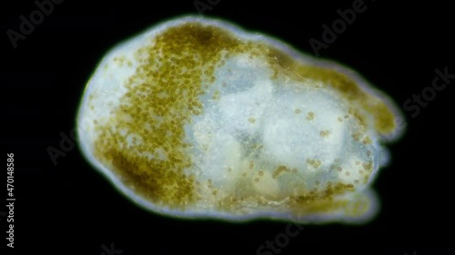 Worm Turbellaria, order Acoela under a microscope. In symbiosis with Zooxanthellae algae, which give him energy. Indian Ocean photo