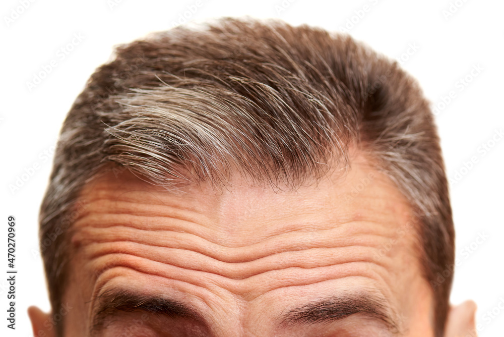 Fototapeta premium Close-up of a mature men forehead with wrinkles.
