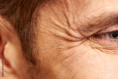 Close-up of wrinkles near the eyes of a middle-aged man.