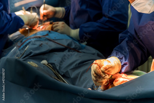 Process surgery of operation using medical equipment in operating room