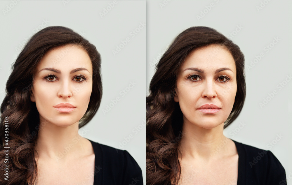 Aging. Mature woman-young woman.Face with skin problem.Showing photos ...