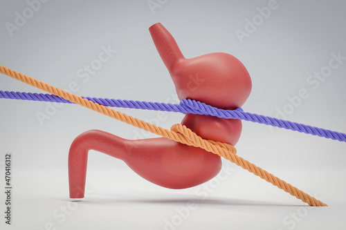 Anatomical model of human stomach, tied with rope.
concept for stomach cramps, feelings of hunger
