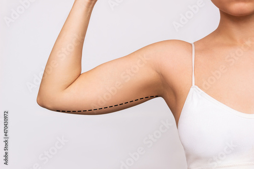 Cropped shot of a young woman with excess fat on her upper arm with marks for liposuction or plastic surgery isolated on a gray background. The loose and saggy muscles. Overweight. Beauty concept photo
