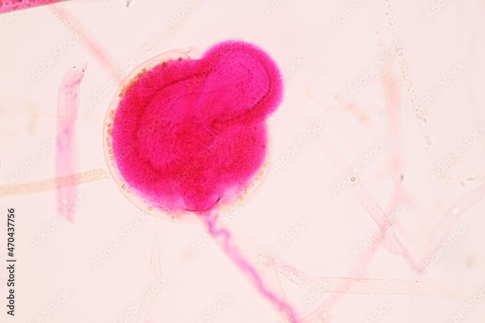 Characteristics of Rhizopus is a genus of common saprophytic fungi on Slide under the microscope for education.
