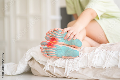 Joint diseases, hallux valgus, plantar fasciitis, woman's leg hurts, pain in the foot, massage of female feet at home photo