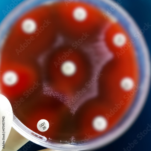 Antibiotic susceptibility. Selective focus show inhibition zone cotrimoxazole or colistin antibiotic. photo