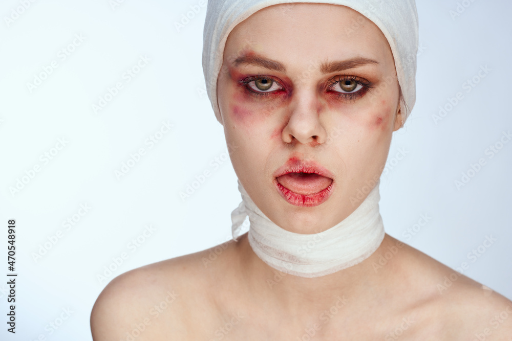 female patient facial injury health problems bruises pain studio lifestyle female patient facial injury health problems bruises pain studio lifestyle