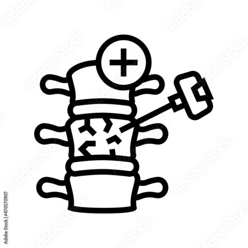 vertebroplasty and kyphoplasty line icon vector. vertebroplasty and kyphoplasty sign. isolated contour symbol black illustration