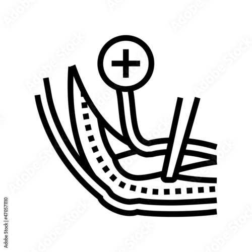 ulnar nerve release line icon vector. ulnar nerve release sign. isolated contour symbol black illustration