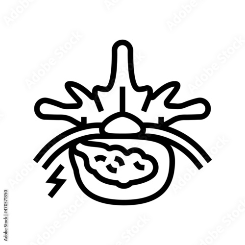 diskectomy patient disease line icon vector. diskectomy patient disease sign. isolated contour symbol black illustration