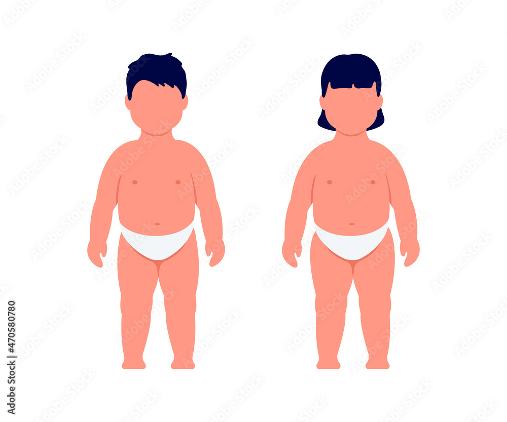 Children overweight, boy and girl obesity, harbinger of diabetes. Check health. Excess weight. Vector illustration Children overweight, boy and girl obesity, harbinger of diabetes. Check health. Excess weight. Vector illustration