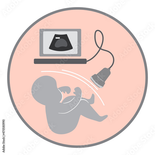 Simple illustration of ultrasound unborn baby in the circle
