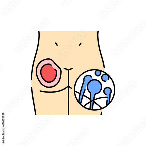 Cutaneous mucormycosis color line icon. Human diseases.