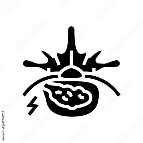 diskectomy patient disease glyph icon vector. diskectomy patient disease sign. isolated contour symbol black illustration