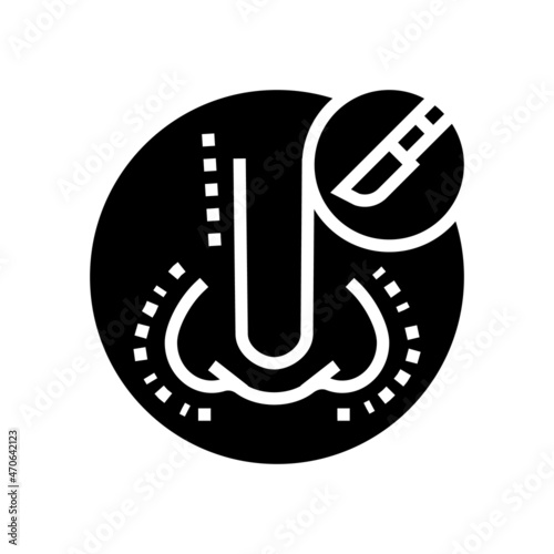 rhinoplasty surgery glyph icon vector. rhinoplasty surgery sign. isolated contour symbol black illustration