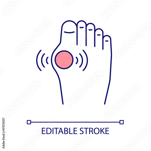 Feet arthritis RGB color icon. Inflammation in foot and toes. Joint disorder. Arthritis and arthrosis. Traumas. Isolated vector illustration. Simple filled line drawing. Editable stroke